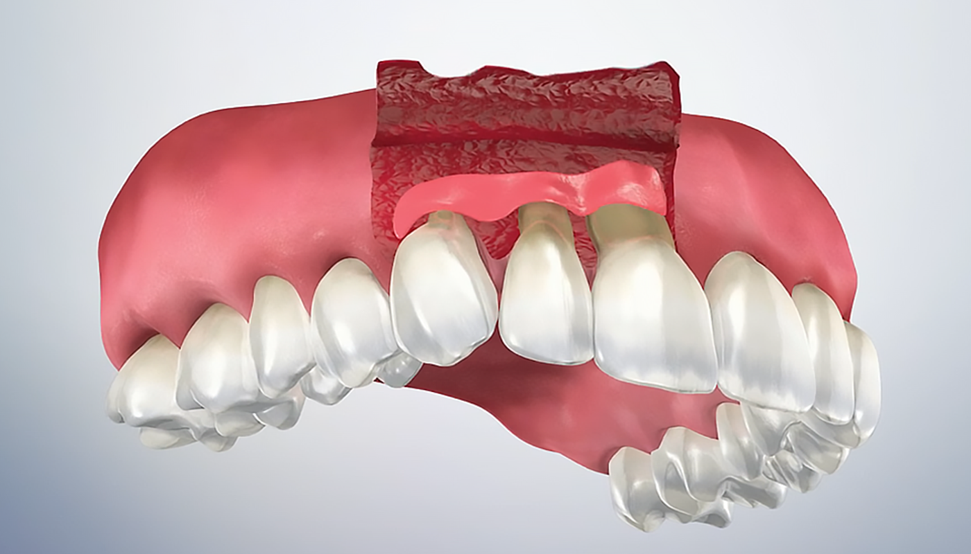 Odontoiatria conservativa